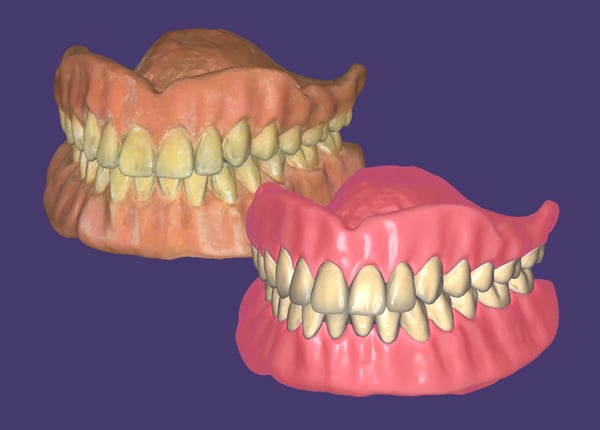 DentalCAD_3_2_Elefsina_Feature_4_Full-Denture_copy_denture